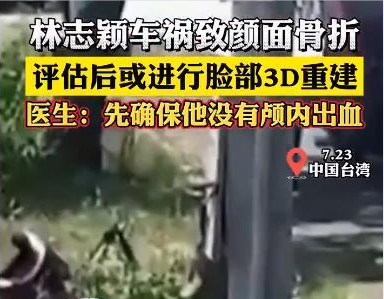 林志穎車禍致顏面骨折——什么是3D臉部重建